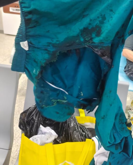 11月25日晚19:30，广州地铁一名26岁李姓男乘客随身携带100mL用于首饰加工的强酸性溶液发生渗漏，发现后自行下车离开、也未告知地铁工作人员；导致13岁的男孩王某跌倒、臀部被灼伤